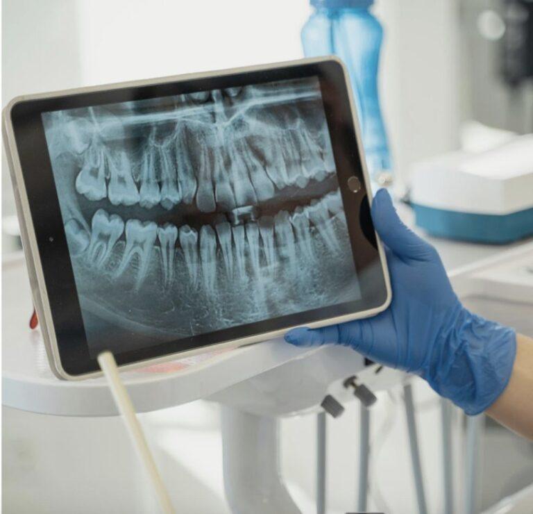Protect Your Smile with NTI Treatment at Clínica Dental la Plaza